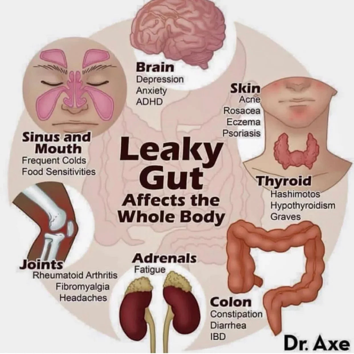 Bone Broth – A Natural Remedy for Leaky Gut